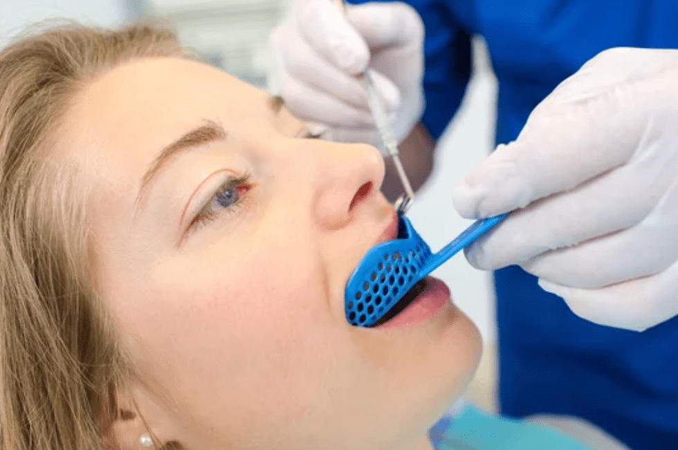 close up of female patient taking impression of her teeth for a custom mouthguard general dentistry dentist in Washington DC