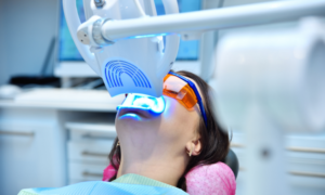 Treatment Options for Discolored Teeth in Washington DC